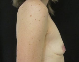 seins profil