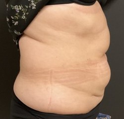 ventre profil avant